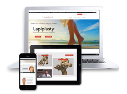 Laptop and mobile devices showing Lapiplasty website
