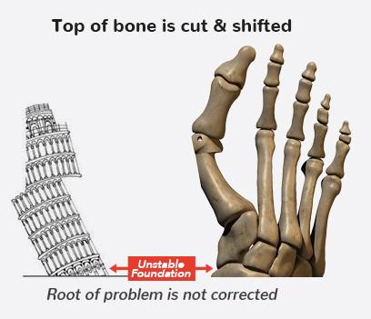 Top of bone is cut and shifted Graphic