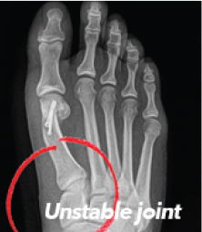 Traditional 2D Surgery X-Ray